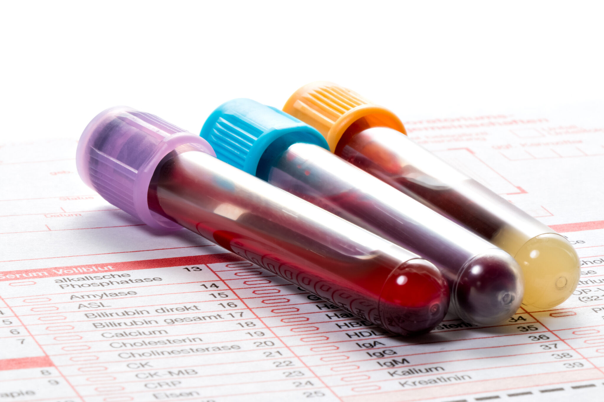 Trends in Type 1 Diabetic Ketoacidosis During COVID-19 Surges at 7 US Centers: Highest Burden on non-Hispanic Black Patients